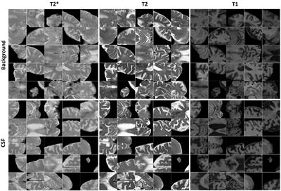 Using transfer learning for automated microbleed segmentation